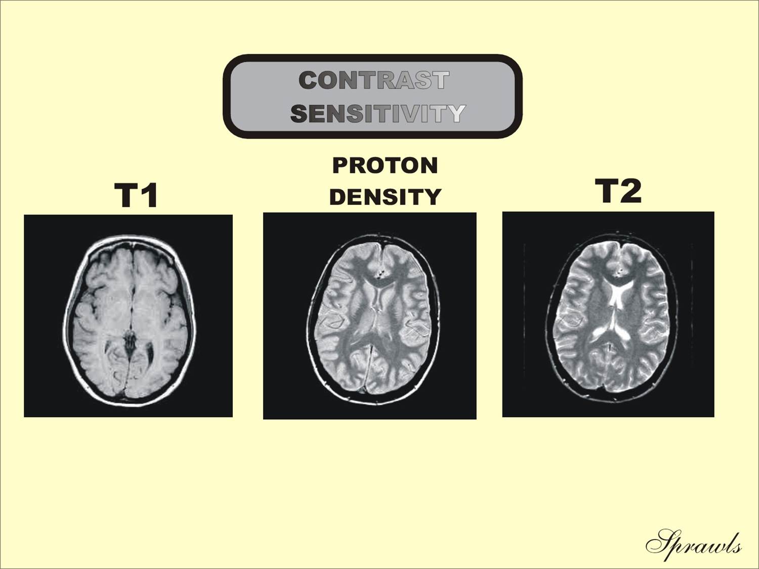 Resonance Image Characteristics
